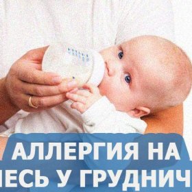 Аллергия на смесь у грудничка: симптомы, причины, что делать