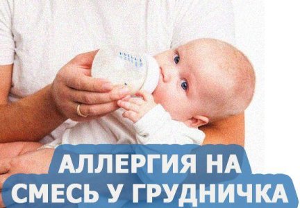 Аллергия на смесь у грудничка: симптомы, причины, что делать